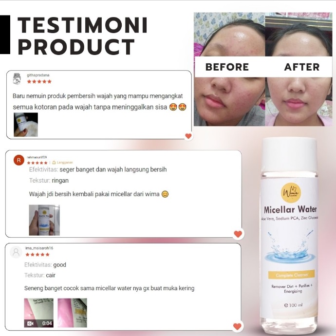 Micellar Water